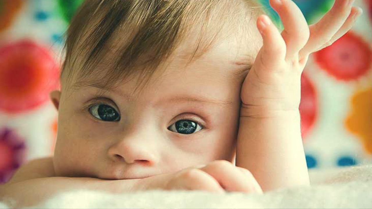 Down Syndrome Symptoms: चेहरे की बनावट अलग, बोलने में देरी और सीखने में कठिनाई क्यों है डाउन सिंड्रोम का संकेत