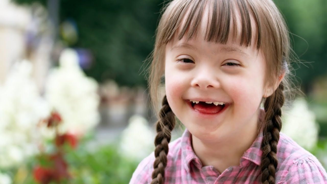 Down Syndrome Symptoms: चेहरे की बनावट अलग, बोलने में देरी और सीखने में कठिनाई क्यों है डाउन सिंड्रोम का संकेत